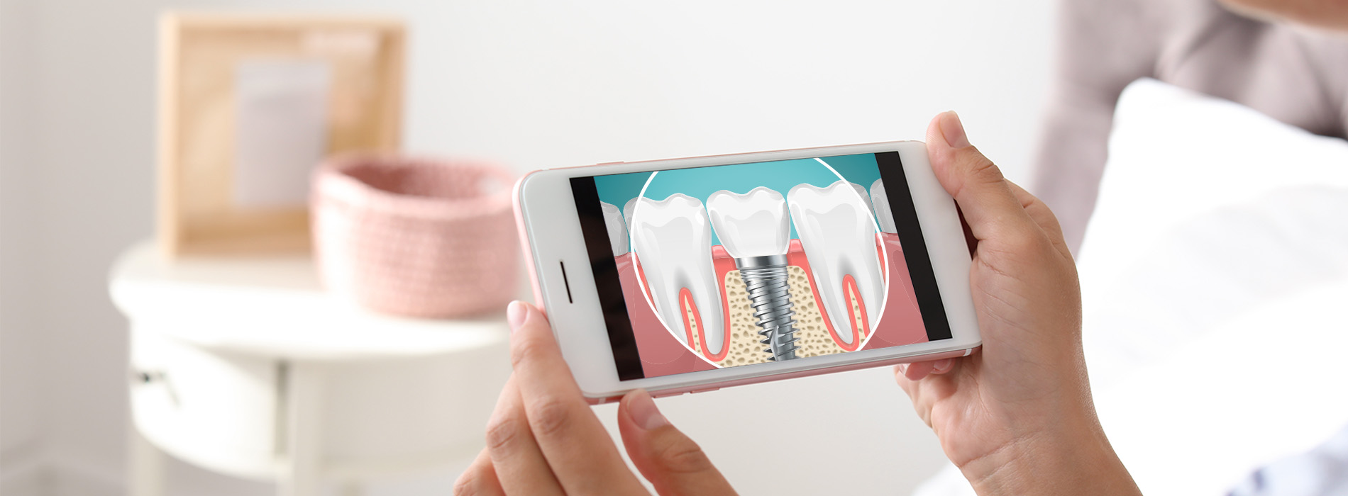 Granger Dentistry | E4D, Dentures and Implant Restorations