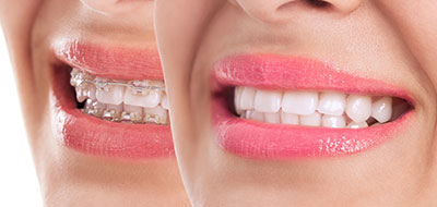 Granger Dentistry | LANAP reg , Sleep Apnea and Digital Radiography