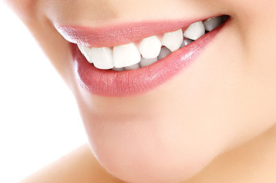 Granger Dentistry | Preventative Program, Implant Restorations and Veneers
