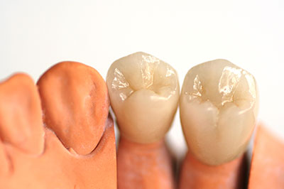Granger Dentistry | Laser Dentistry, Teeth Whitening and ZOOM  Whitening