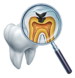 Granger Dentistry | Air Abrasion, E4D and Dental Cleanings
