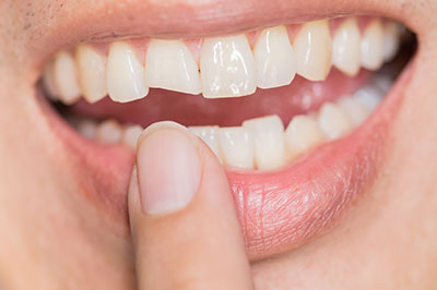 Granger Dentistry | Laser Dentistry, Preventative Program and Pediatric Dentistry