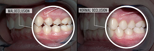 Granger Dentistry | Oral Cancer Screening, Botox reg  and Snoring Appliances