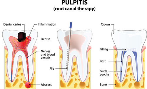 Granger Dentistry | Periodontal Treatment, Pediatric Dentistry and CBCT