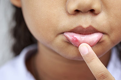 Granger Dentistry | Dermal Fillers, Juvederm reg  and Implant Dentistry