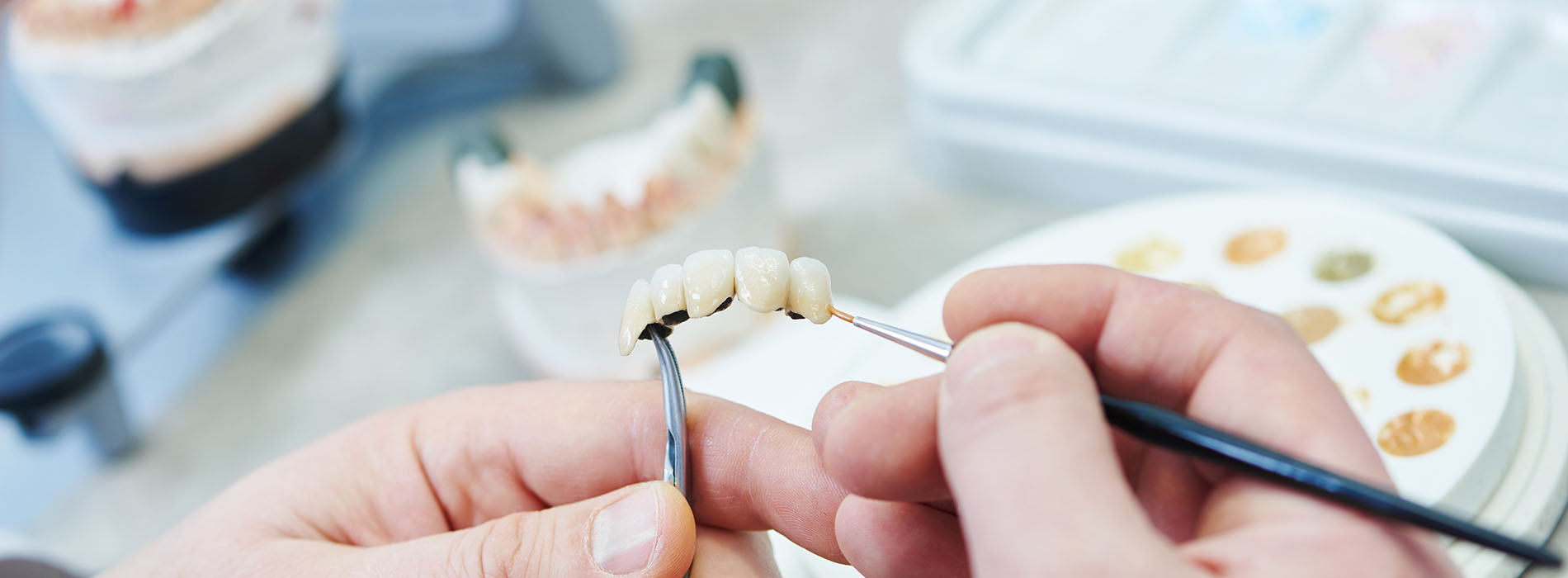 Granger Dentistry | Orthodontics, All-on-4 reg  and Full Mouth Reconstruction