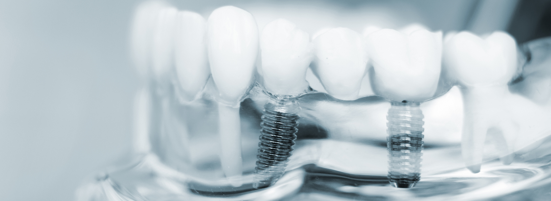 Granger Dentistry | Orthodontics, Digital Radiography and All-on-6 reg 