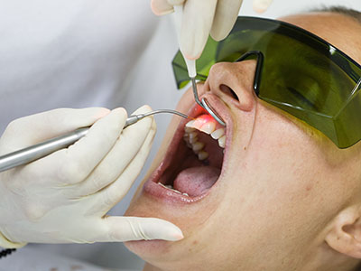 Granger Dentistry | Extractions, CEREC and Root Canals