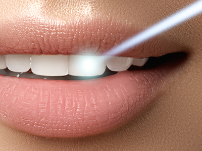 Granger Dentistry | E4D, CEREC and Dentures